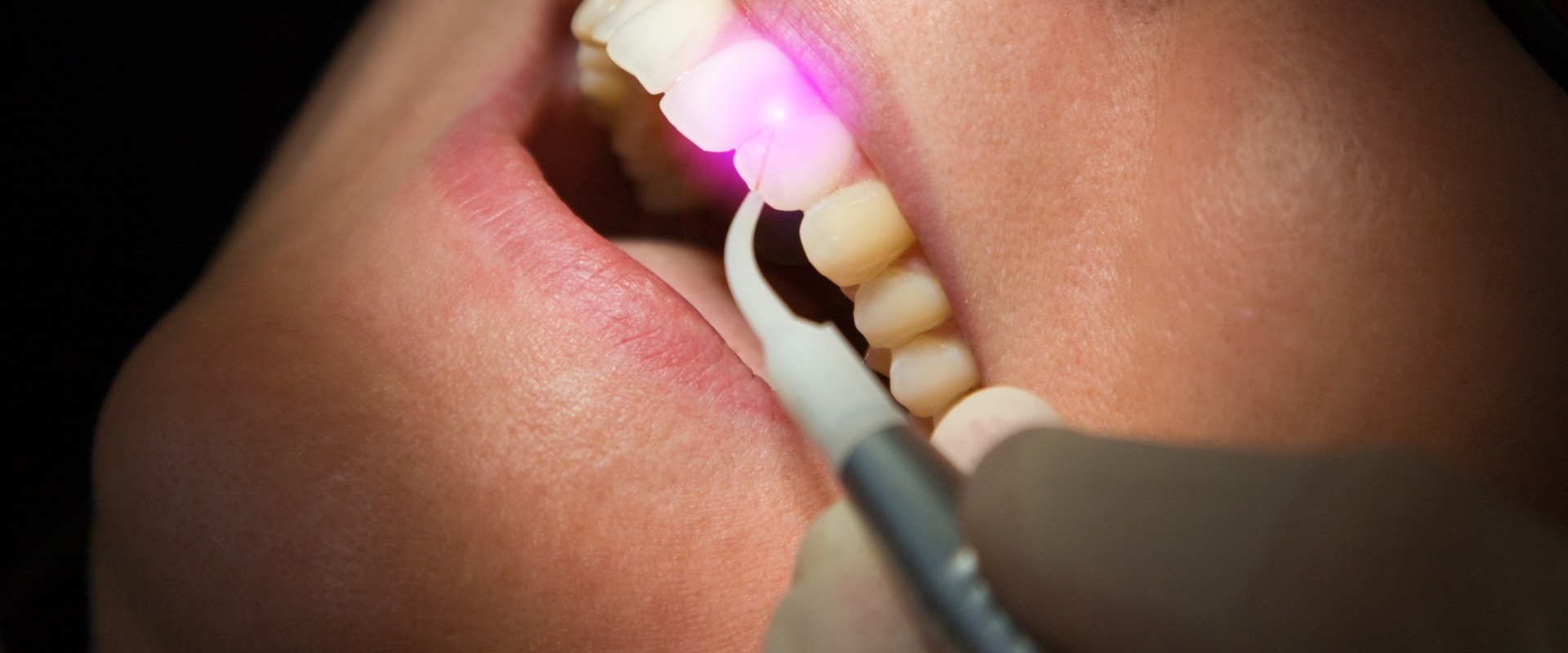 Is laser treatment good for gums?