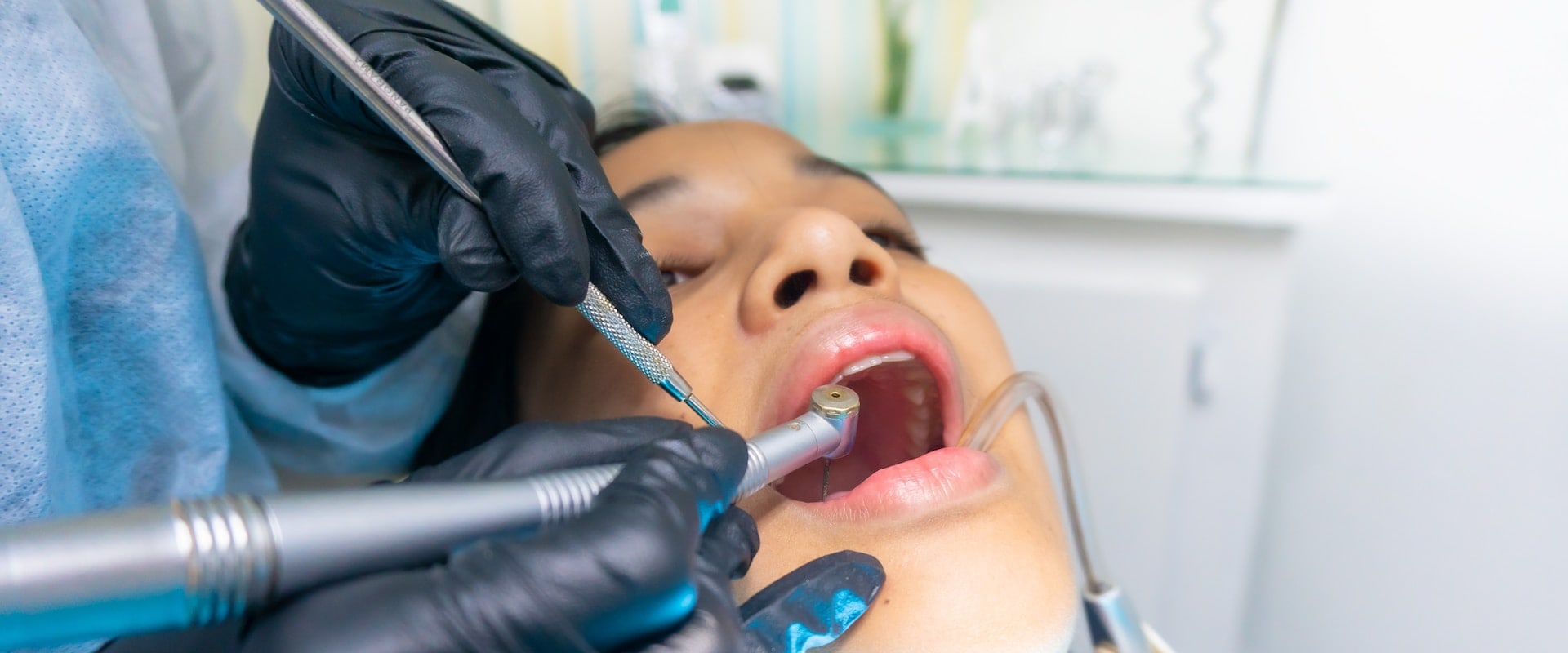 The Versatility Of Laser Dentistry: Addressing Common Dental Issues In Boerne, TX