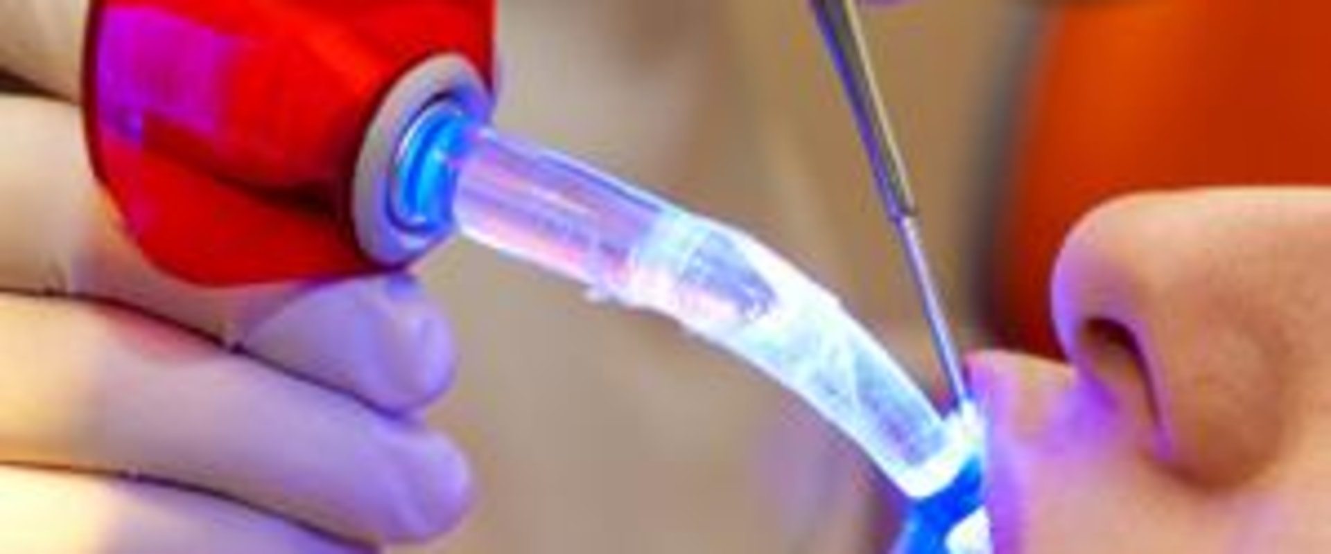 Laser Dentistry For Kids In Brambleton, VA: Everything Parents Should Know