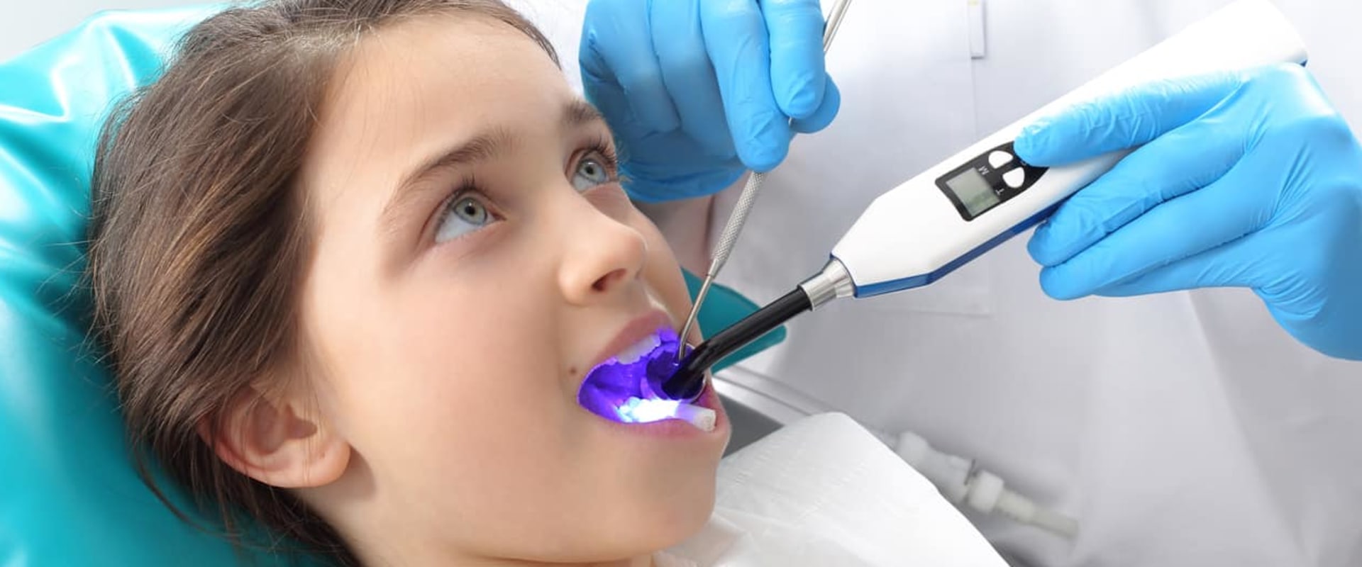Is laser filling good for teeth?