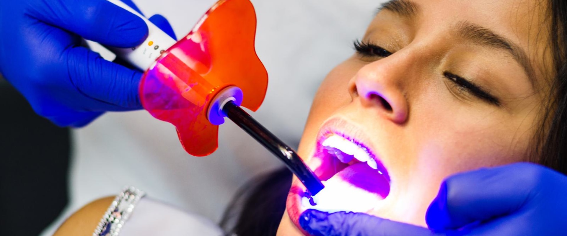 The Benefits Of Laser Dentistry: A Guide To Laser Gum Treatment In Austin, TX