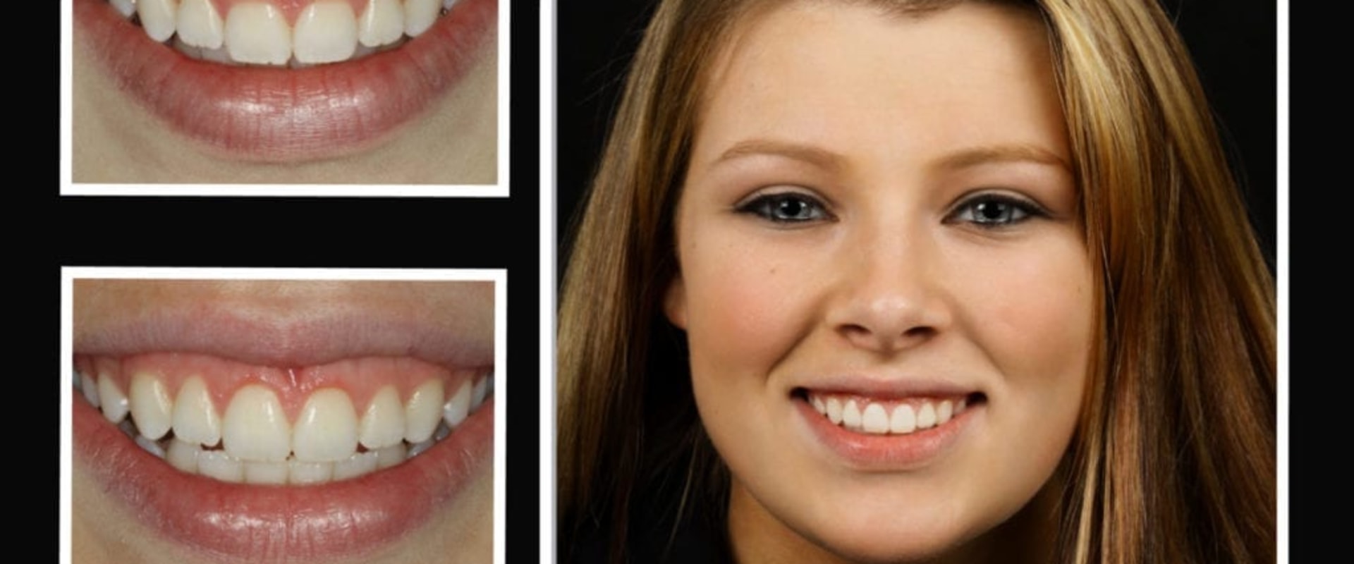 How much does laser dentistry cost?