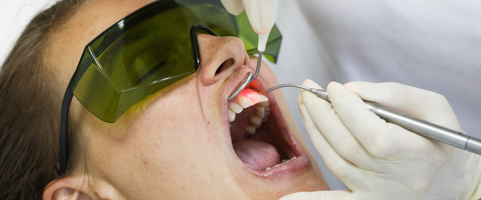 Does laser surgery in the mouth hurt?