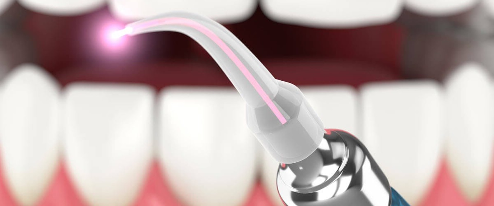 Who regulates the rules for lasers used in dentistry?