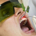 Which type of soft tissue laser is most popular in dentistry?