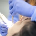 What Are The Significance Of Having A Qualified Dentist In Waco Texas For Laser Dentistry Treatment?