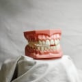 How Laser Dentistry Enhances Orthodontics in Fort Walton Beach