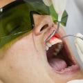 Is lasering gums painful?