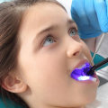 Is laser filling good for teeth?