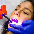 Laser Dentistry In London: What Are The Benefits And How Does It Work