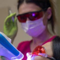 Get Rid Of Yellow Teeth With Laser Whitening In Austin: A Comprehensive Guide