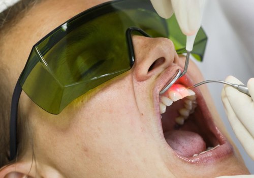 Reasons To Choose Laser Dentistry For Your Dental Care In Mansfield