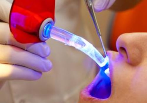 Laser Dentistry For Kids In Brambleton, VA: Everything Parents Should Know