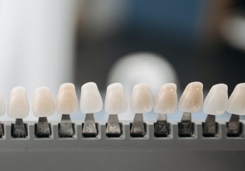 Experience The Benefits Of Laser Dentistry For Porcelain Veneers In Waco