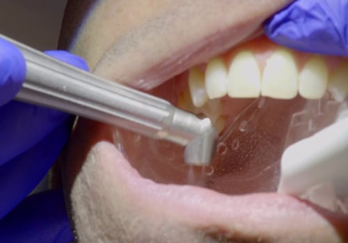What is solea laser dentistry?